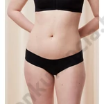 Kép 3/4 - TRIUMPH FLEX SMART HIGHLEG BRAZILIAN EX ALSÓNEMŰ